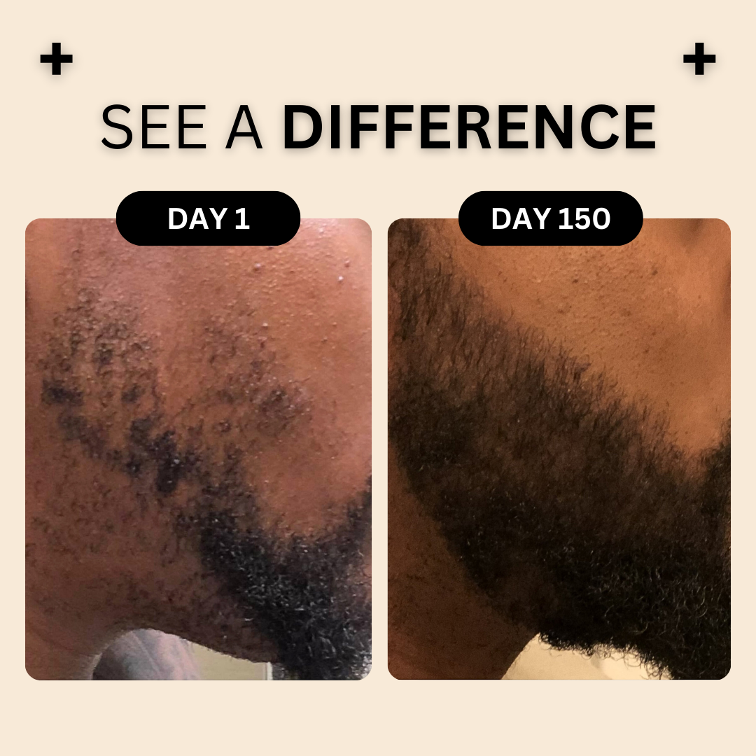 Beard Growth Kit - Velmar